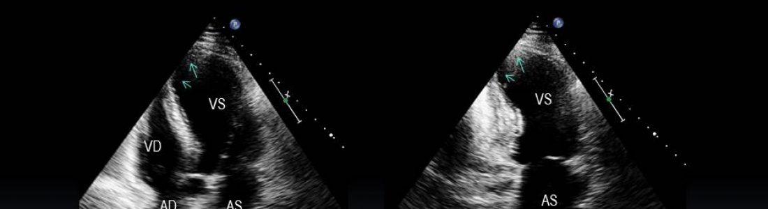 201911181350-baldacci-diapositiva07