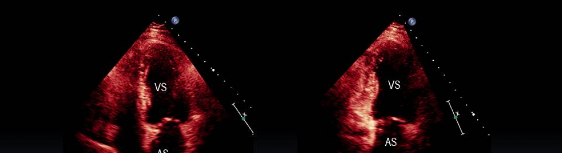 201911181350-baldacci-diapositiva09