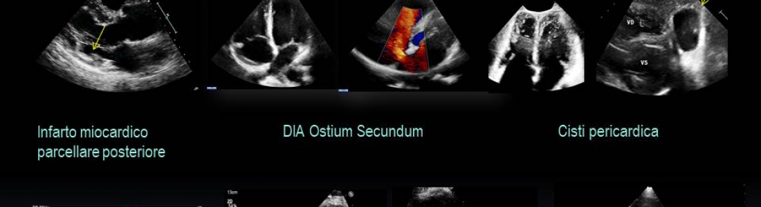 diapositiva14